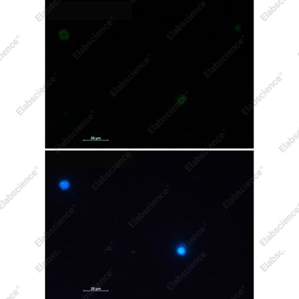 Recombinant CD79a Monoclonal Antibody - 3