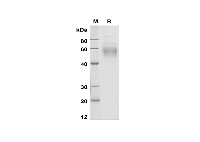 Recombinant Rat IL-2 Protein(His Tag)-产品推荐-1