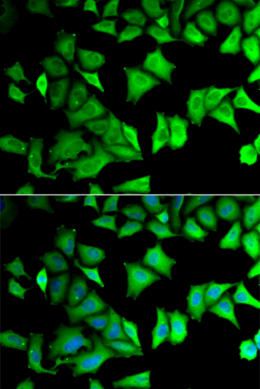 Immunofluorescence analysis of MCF-7 cells using RPS12 Polyclonal Antibody Blue: DAPI for nuclear staining.