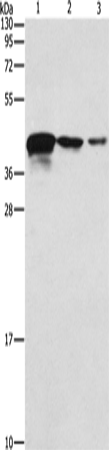 Western Blot analysis of Human endometrial carcinoma tissue, A172 and U937 cell using TWF2 Polyclonal Antibody at dilution of 1:800