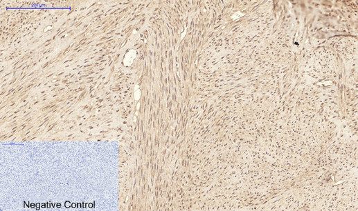 Immunohistochemistry of paraffin-embedded Human uterus tissue using ATG7 Monoclonal Antibody at dilution of 1:200.