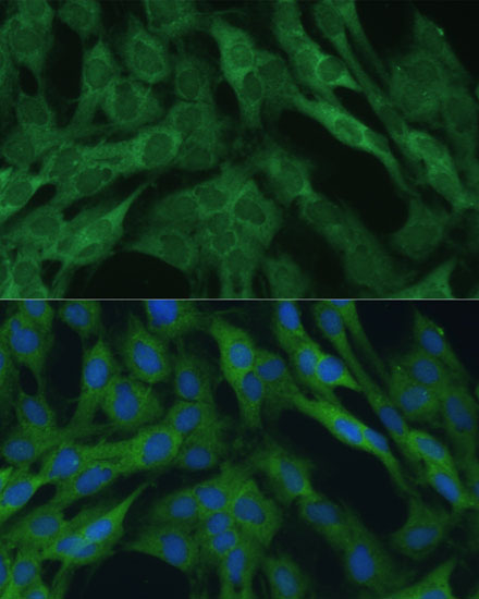 Immunofluorescence analysis of C6 cells using IDH1 Polyclonal Antibody at dilution of  1:100 (40x lens). Blue: DAPI for nuclear staining.