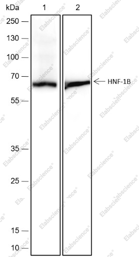 Recombinant HNF-1B Monoclonal Antibody - 2