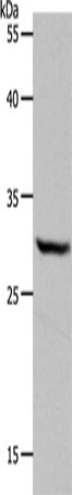 Western Blot analysis of Hela cell using NQO1 Polyclonal Antibody at dilution of 1:600