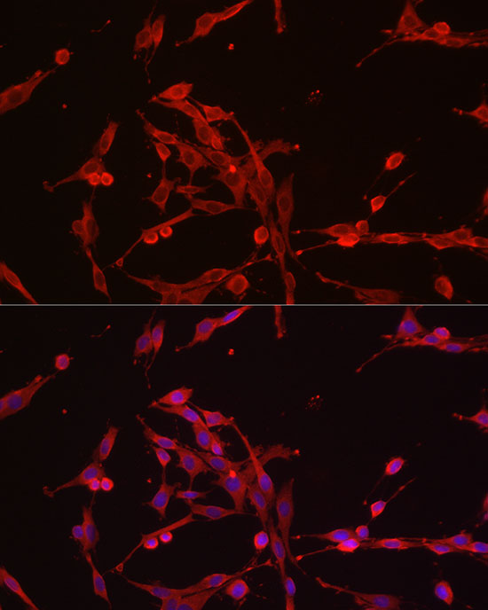 Immunofluorescence analysis of PC-12 cells using HK3 Polyclonal antibody at dilution of 1:150 (40x lens). Blue: DAPI for nuclear staining.