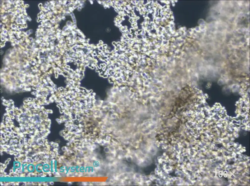 NCI-H526 Cell Complete MediumNCI-H526 Cell Complete Medium - 3