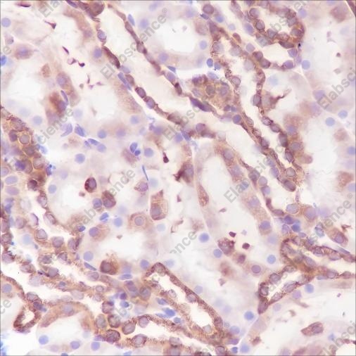 Recombinant Phospho-S6 Ribosomal Protein (Ser240, 244) Monoclonal Antibody - 5