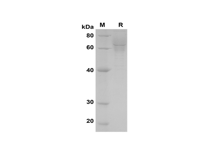 Recombinant Mouse CD147/BSG/Basigin Protein (His Tag)-产品推荐-1