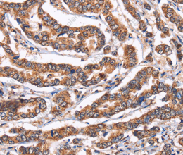 Cyclophilin F Polyclonal Antibody - 2