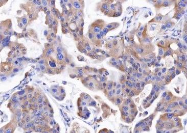 Recombinant beta Tubulin Monoclonal Antibody-searchlist-3