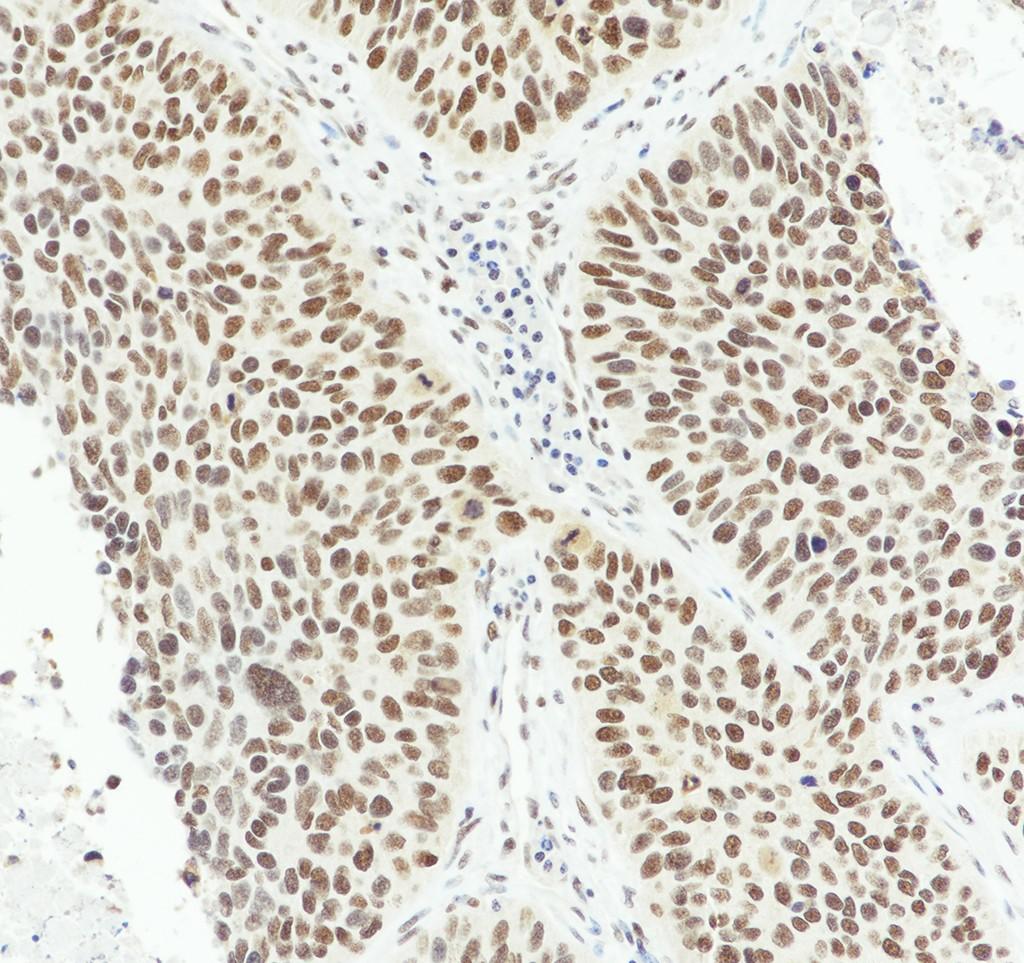 Recombinant RBBP7/RBBP4 Monoclonal Antibody - 2