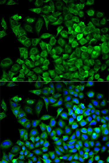 Immunofluorescence analysis of A549 cells using ALDOA Polyclonal Antibody