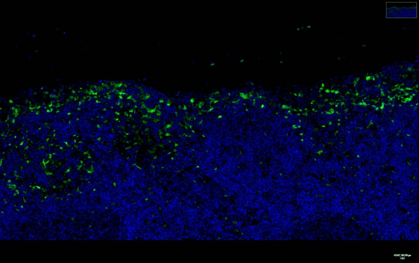 Recombinant p38 Monoclonal Antibody - small - 5