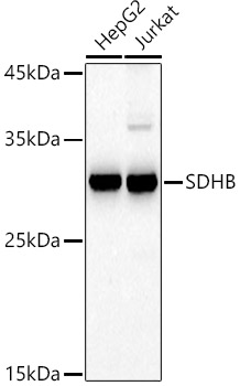 Western blot analysis of extracts of various cell lines using SDHB  Polyclonal Antibody at 1:500 dilution.