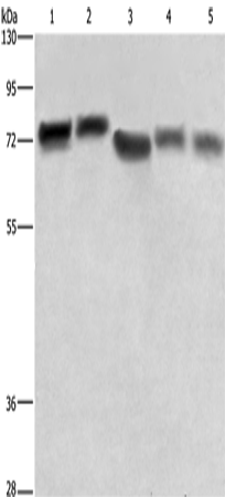 Western Blot analysis of Hela cell and Human brain tissue, 293T cell, Human hepatocellular carcinoma tissue and NIH/3T3 cell using RDX Polyclonal Antibody at dilution of 1:600