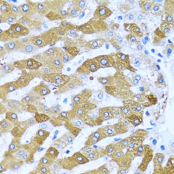 Immunohistochemistry of paraffin-embedded human liver using IFIT3 Polyclonal antibody at dilution of 1:100 (40x lens).Perform microwave antigen retrieval with 10 mM PBS buffer pH 7.2 before commencing with IHC staining protocol.