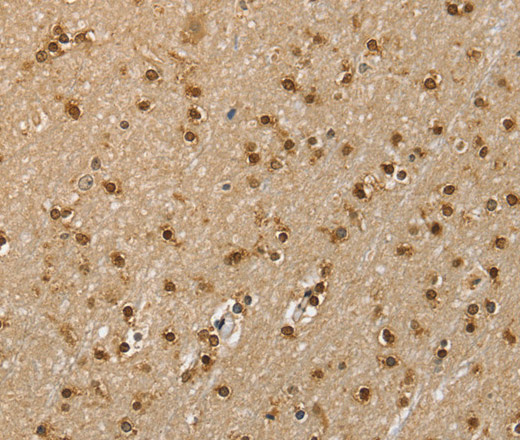 Immunohistochemistry of paraffin-embedded Human brain  using RNH1 Polyclonal Antibody at dilution of 1:40