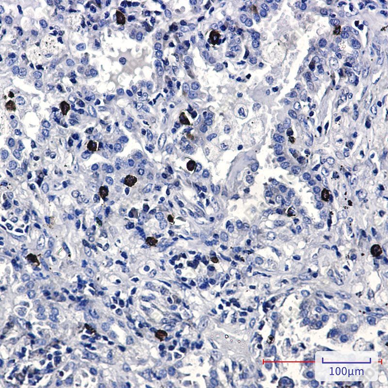 Recombinant FLI1 Monoclonal Antibody - 2