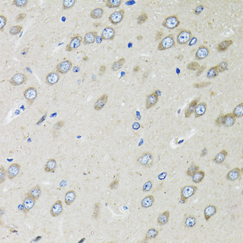 Immunohistochemistry of paraffin-embedded Rat brain using OGDH Polyclonal Antibody at dilution of 1:100 (40x lens).