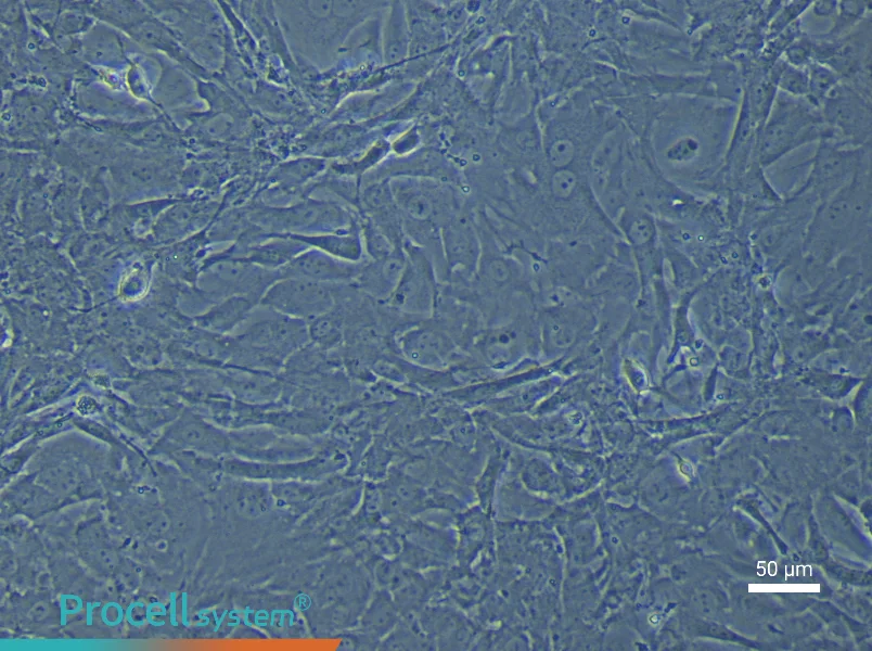 Rat Pulmonary Artery Fibroblast Complete Medium - 5