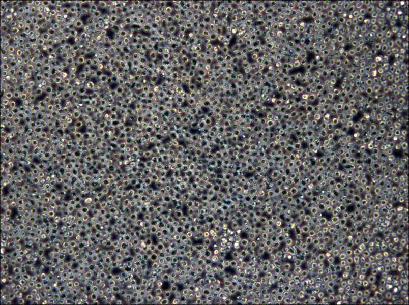 Z-138 Cell Complete Medium - 4