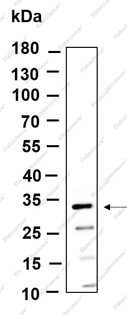 Recombinant MTX3 Monoclonal Antibody - 1