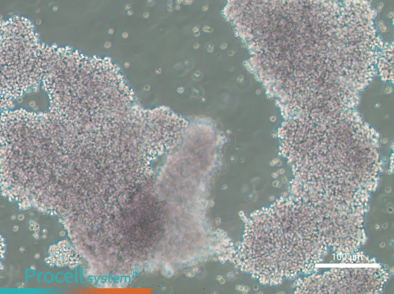 NCI-H1417NCI-H1417 - 3