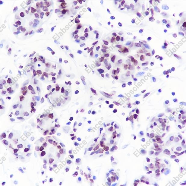 Recombinant Histone H1 (CT) Monoclonal Antibody - 2