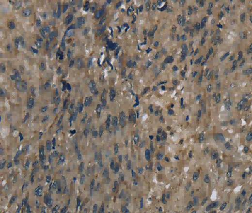 FTO Polyclonal Antibody - 3