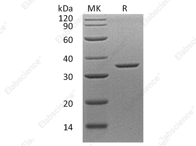 Recombinant Human Annexin A8/ANXA8 Protein - 1