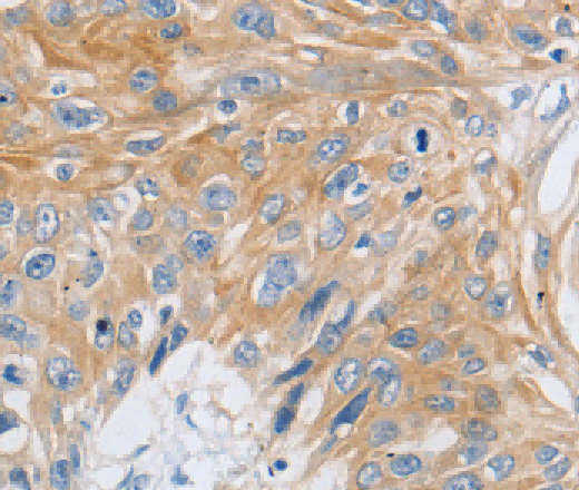 SLC16A7 Polyclonal Antibody - 2