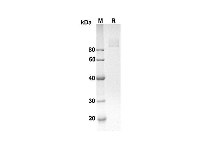 Recombinant Mouse IL2 Protein (His Tag)-产品推荐-1