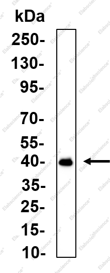 Recombinant SPOP Monoclonal Antibody - 1