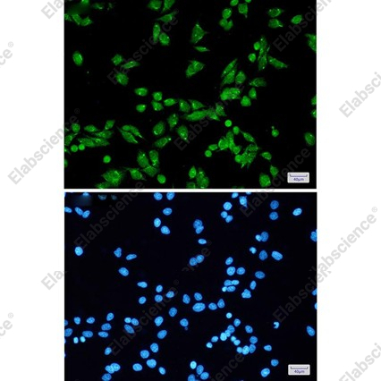 Recombinant PRPF31 Monoclonal Antibody - 3