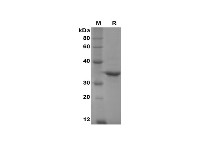 Recombinant Mouse CXCL10 Protein (Sumo Tag)-产品推荐-1