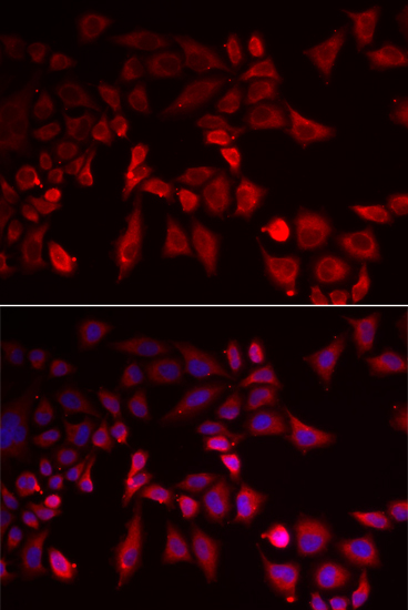 Immunofluorescence analysis of MCF-7 cells using PYGL Polyclonal Antibody