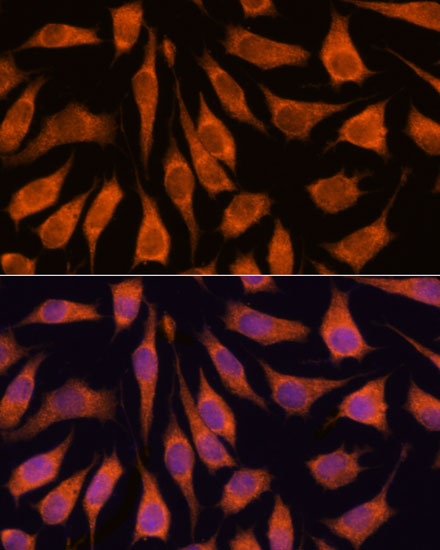 Immunofluorescence analysis of L929 cells using GOLPH3 Polyclonal Antibody at dilution of  1:100. Blue: DAPI for nuclear staining.