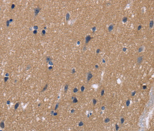 Immunohistochemistry of paraffin-embedded Human brain  tissue using KCNJ11 Polyclonal Antibody at dilution 1:40