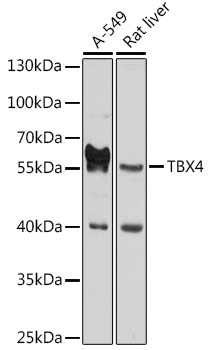 Western blot analysis of extracts of various cell lines using TBX4 Polyclonal Antibody at 1:1000 dilution.