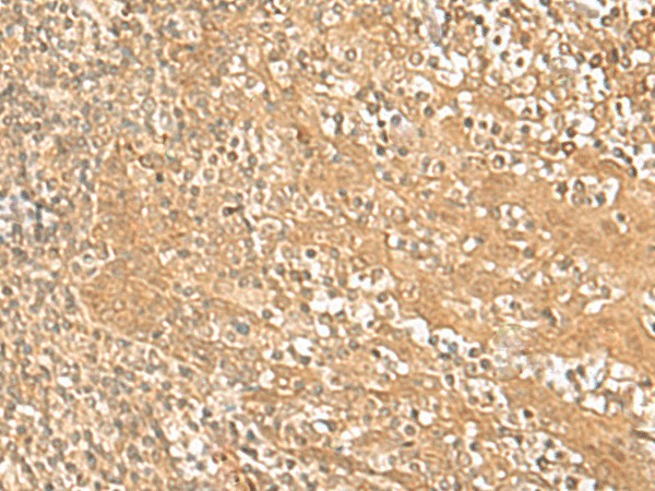 Immunohistochemistry of paraffin-embedded Human tonsil tissue  using HMBOX1 Polyclonal Antibody at dilution of 1:30(?200)