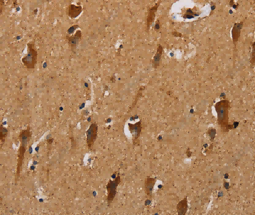 NDUFS3 Polyclonal Antibody - 3