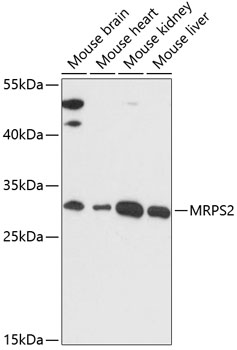 Western blot analysis of extracts of various cell lines using MRPS2 Polyclonal Antibody at dilution of 1:3000.