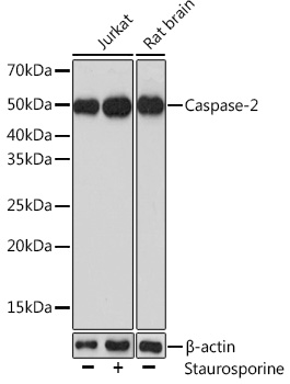 Western blot analysis of extracts of various cell lines using CASP2 Polyclonal Antibody at 1:1000 dilution.Jurkat cells were treated by Staurosporine(1uM) at room temperature for 3 hours.