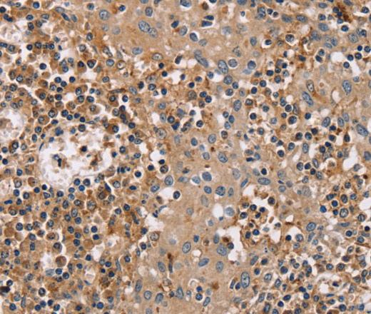 Immunohistochemistry of paraffin-embedded Human tonsil tissue using FAIM2 Polyclonal Antibody at dilution 1:40