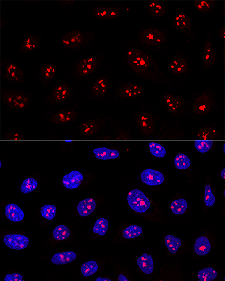 Confocal immunofluorescence analysis of U2OS cells using MYBBP1A Polyclonal Antibody at dilution of  1:200. Blue: DAPI for nuclear staining.