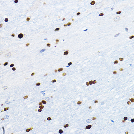 Immunohistochemistry of paraffin-embedded mouse brain using SOX10 Polyclonal Antibody at dilution of 1:100 (40x lens).Perform high pressure antigen retrieval with 10 mM citrate buffer pH 6.0 before commencing with IHC staining protocol.