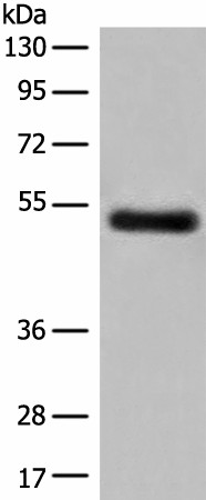 Western blot analysis of Human breast cancer tissue lysate  using GK5 Polyclonal Antibody at dilution of 1:500