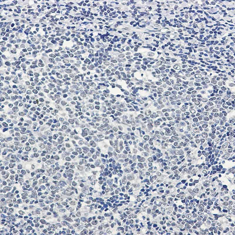 Immunohistochemistry of PTBP1 in paraffin-embedded Human tonsil using PTBP1 Rabbit mAb at dilution 1:50