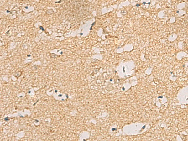 CNST Polyclonal Antibody - small - 2
