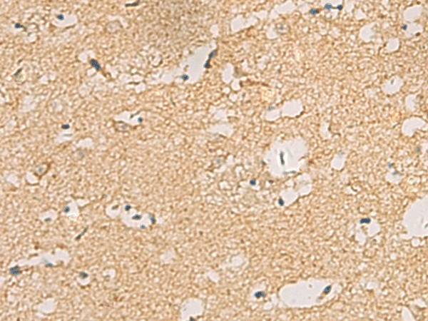 Immunohistochemistry of paraffin-embedded Human brain tissue  using CNST Polyclonal Antibody at dilution of 1:70(?200)